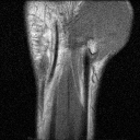 animated GIF of MRI reconstruction